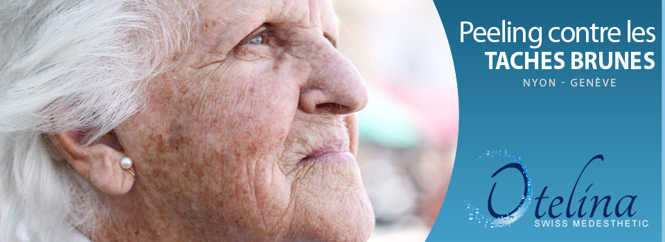 Peeling contre les tâches brunes Peeling contre les tâches brunes