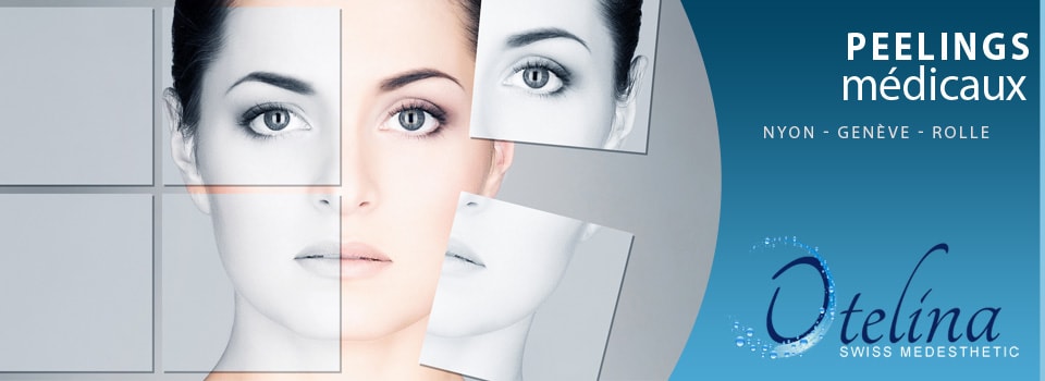 peeling chimique pour le corps peeling chimique pour le corps